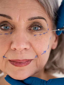 La Vie MD: Botox Treatment in Danville