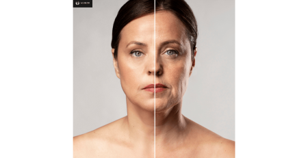 How to Avoid Ozempic Face Essential Tips & Prevention Strategies