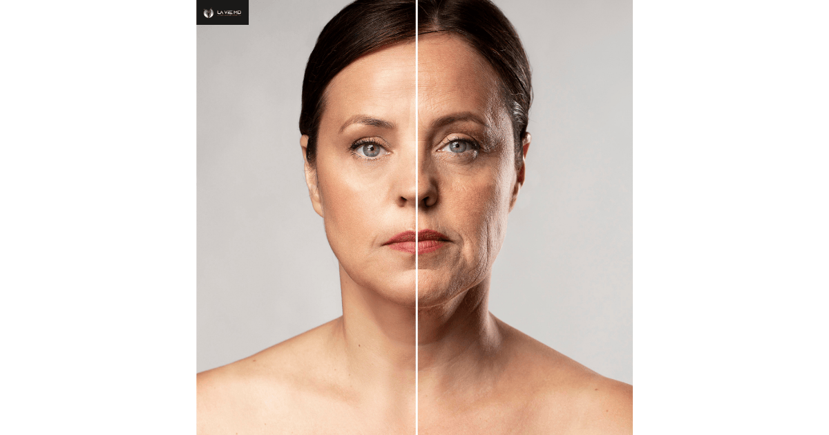 How To Avoid Ozempic Face