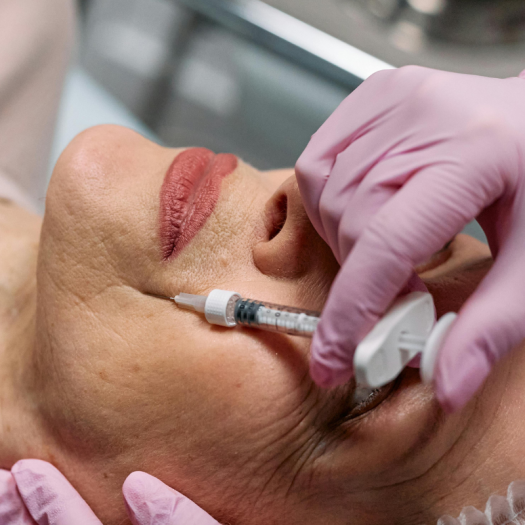 The Incredible Benefits of Dermal Fillers: Rejuvenate Your Skin with Lasting Results