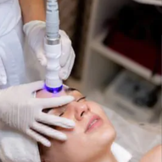 Post-Treatment Care for Acne Laser Treatment