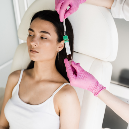 Top Benefits of PRP Hair Treatment: Is It Right for You? (Expert Recommendations)