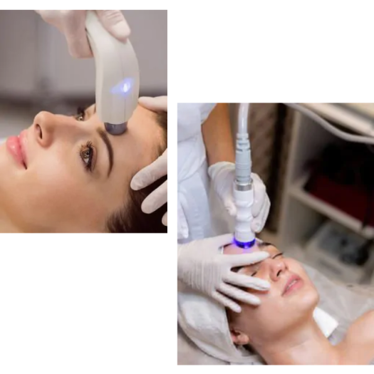 Adult Acne Treatments: Proven Strategies and Practical Tips
