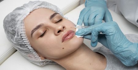 Lip Filler injection