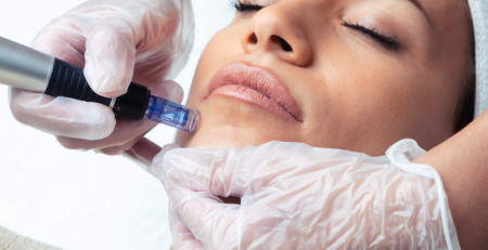 Exosome Microneedling: How It Enhances Collagen and Skin Repair