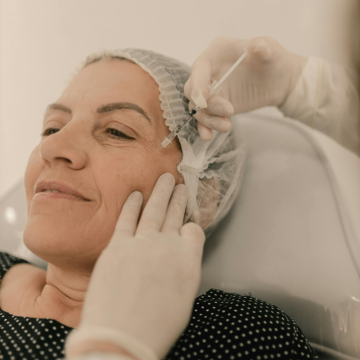 Sculptra and Fillers