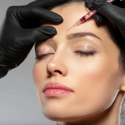 Botox treatment