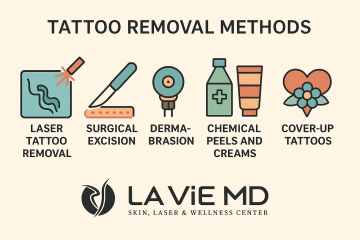 Tattoo removal