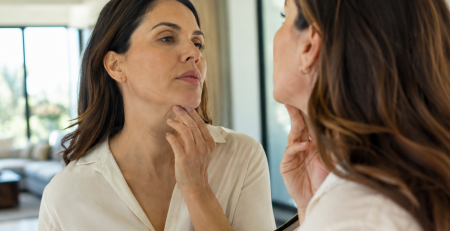 kybella double chin