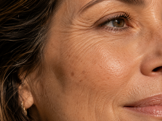 wrinkle treatment