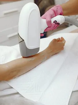 Laser hair removal Treatment