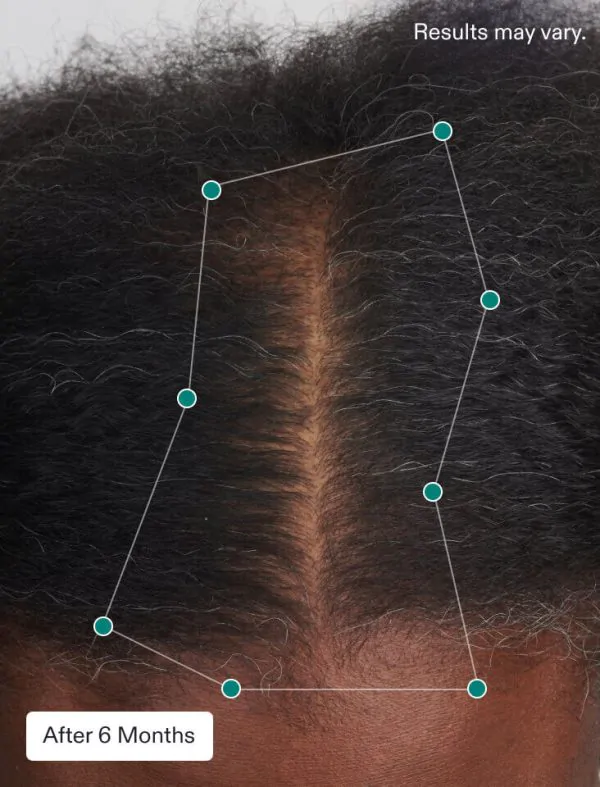 La Vie MD: Nutrafol_Women's_Balance_Hair_Growth4