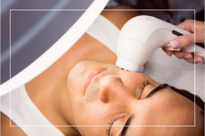 La Vie MD: Hyperpigmentation-Intense-Pulsed-Light-Therapy