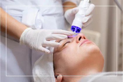 La Vie MD: Hyperpigmentation-Laser-Therapy
