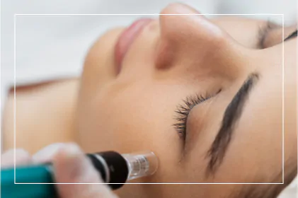 La Vie MD: Hyperpigmentation-Microneedling