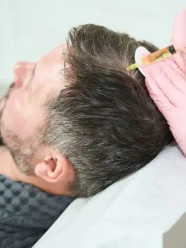 hair restoration & scalp treatments 3