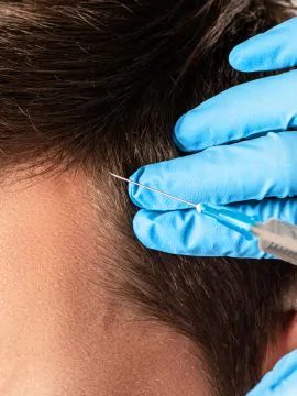hair restoration & scalp treatments 2