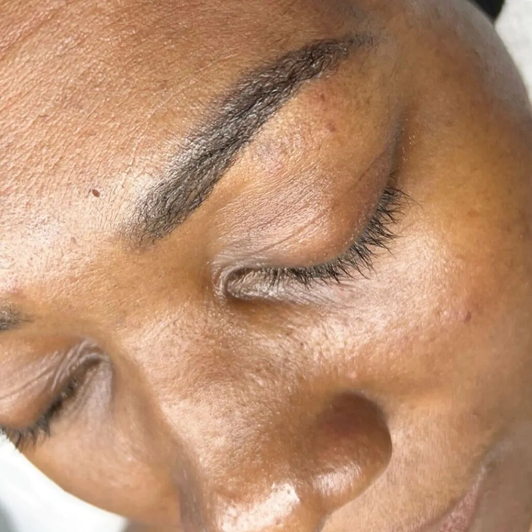 skin rejuvenation before 1