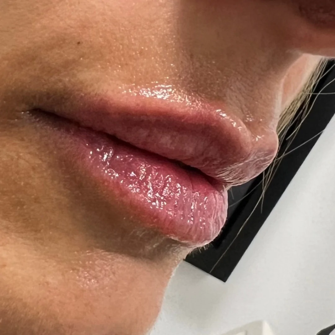 c'est la vie lip filler Stream C'EST LA VIE (Lip Filler) by Z1NO main image 1