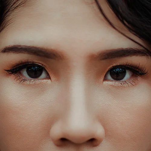 Non-Surgical Rhinoplasty