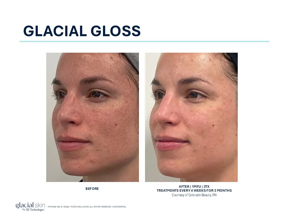 glutathione injection dublin Services In Dublin