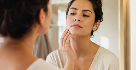 hirsutism